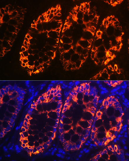 KRT19 Antibody
