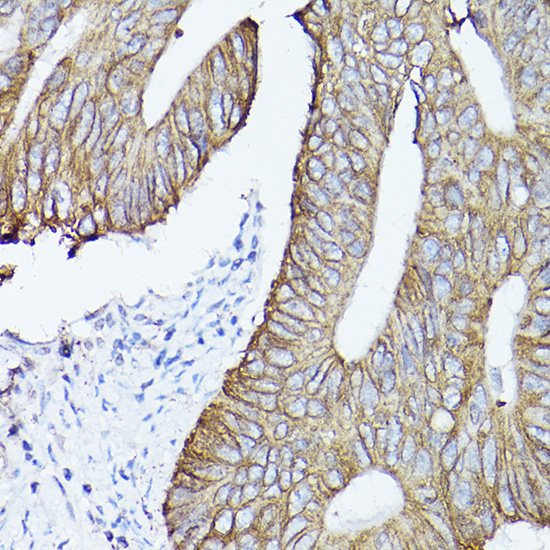 KRT19 Antibody