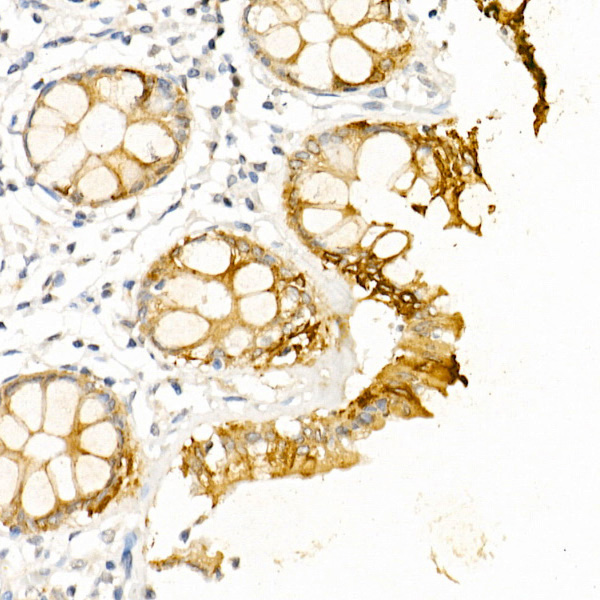 KRT19 Antibody