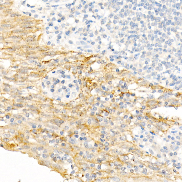 KRT19 Antibody