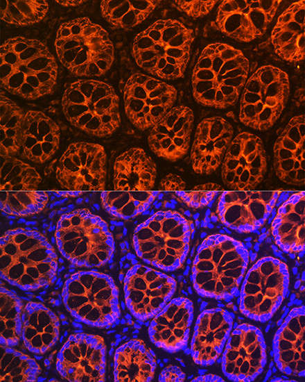 KRT19 Antibody