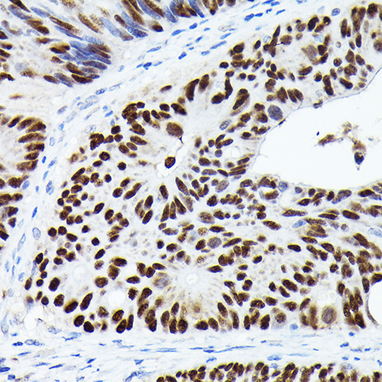 TP53 Antibody