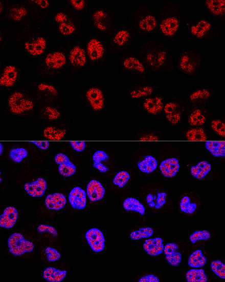 TP53 Antibody