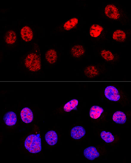 TP53 Antibody