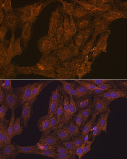 RARA Antibody