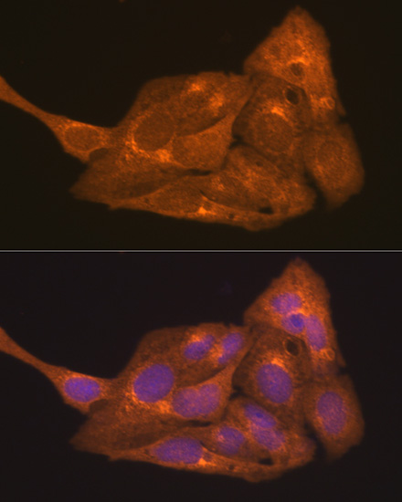 RARA Antibody