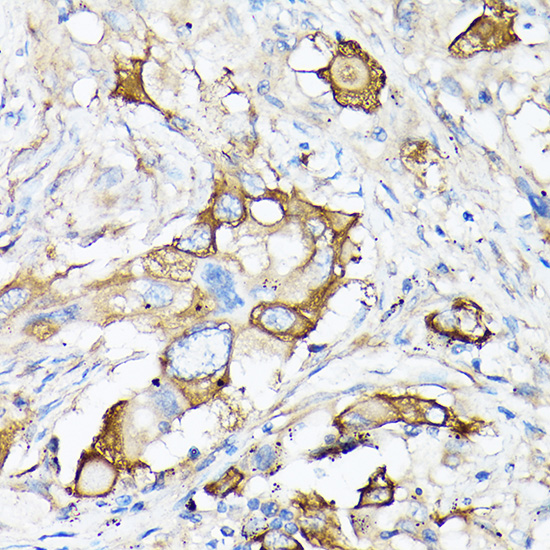 MMP7 Antibody