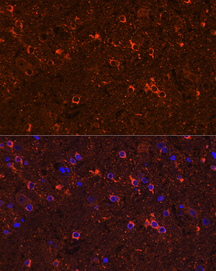 GAD2 Antibody