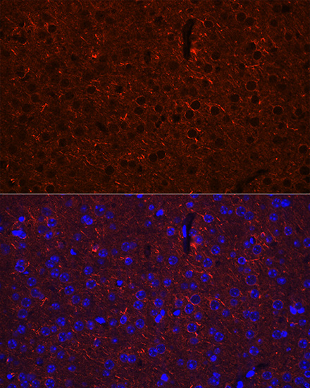 GAD2 Antibody