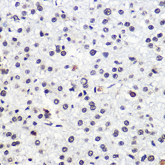 MSH6 Antibody