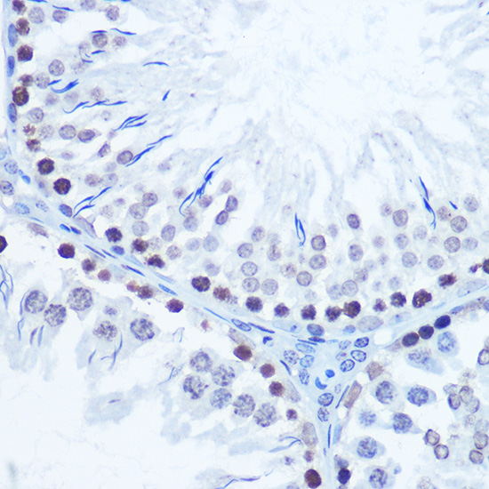 MSH6 Antibody