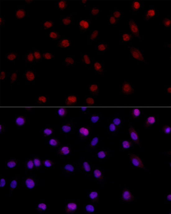 MSH6 Antibody