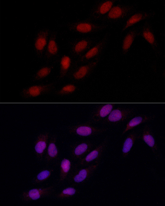 MSH6 Antibody