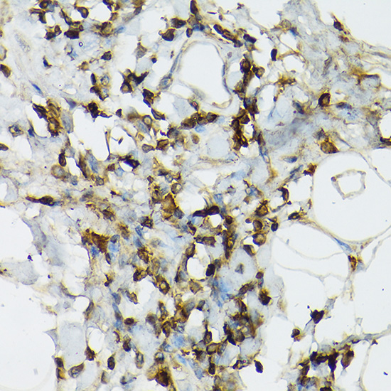 TLR1 Antibody