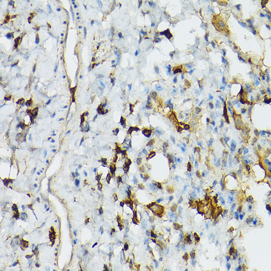 TLR1 Antibody