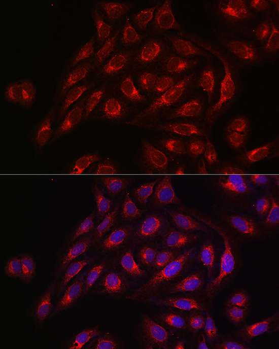 TLR1 Antibody