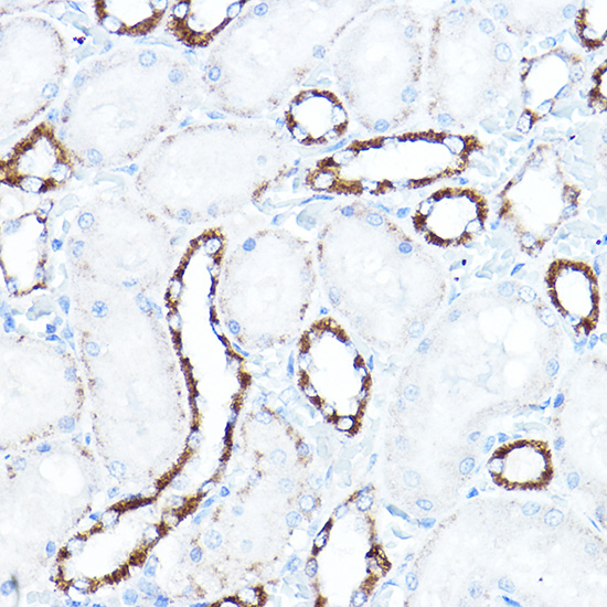 HK1 Antibody