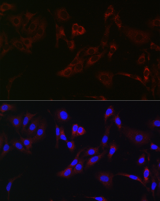 HK1 Antibody