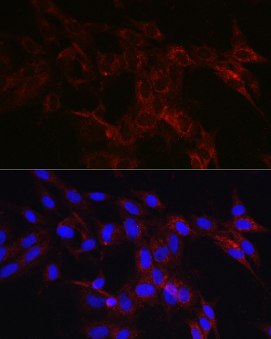 HK1 Antibody