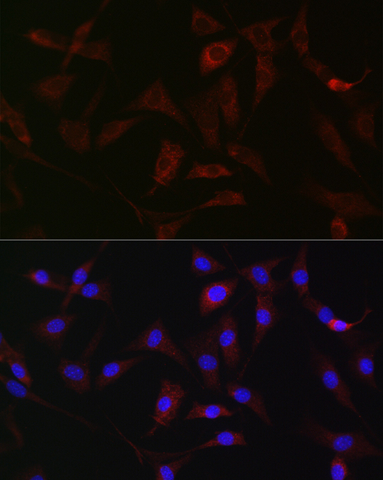 HK1 Antibody