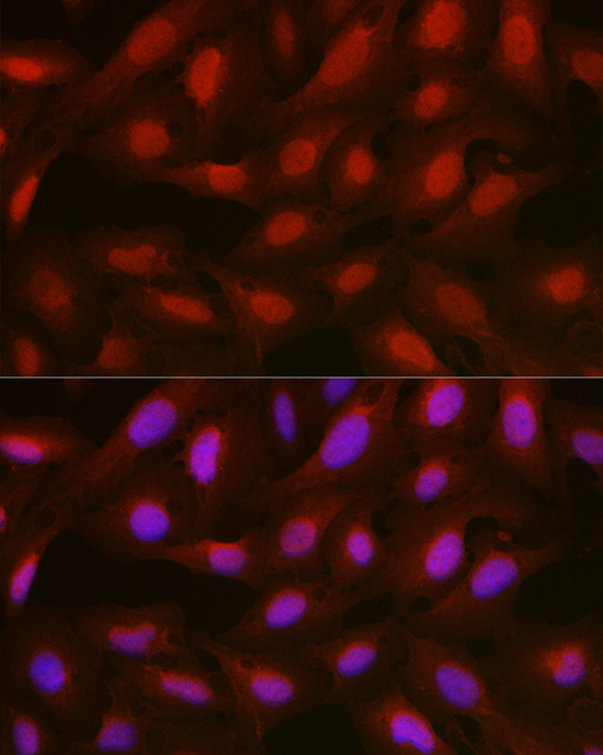 ANXA1 Antibody