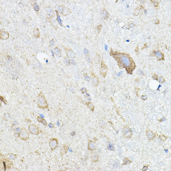 HGF Antibody