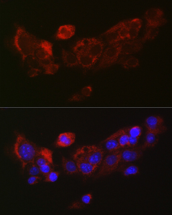 HGF Antibody