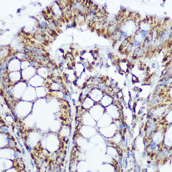 SOD2 Antibody