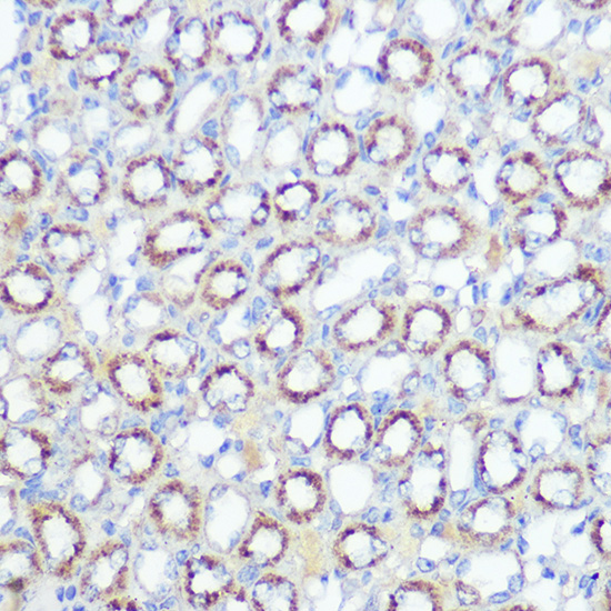 SOD2 Antibody