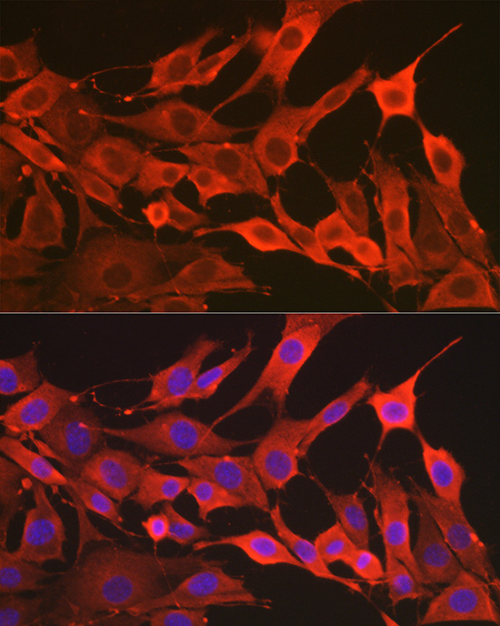 SOD2 Antibody