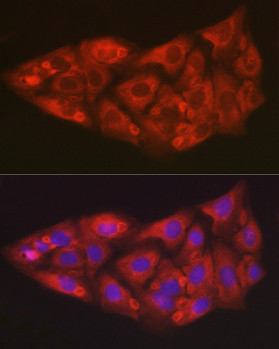 SOD2 Antibody