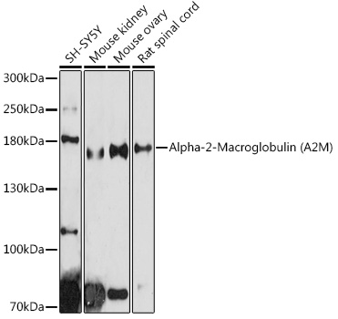 A2M Antibody