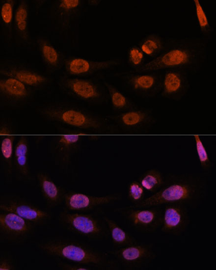 THRB Antibody