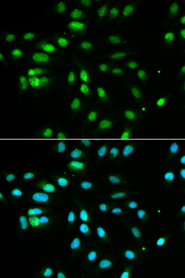 PAX3 Antibody