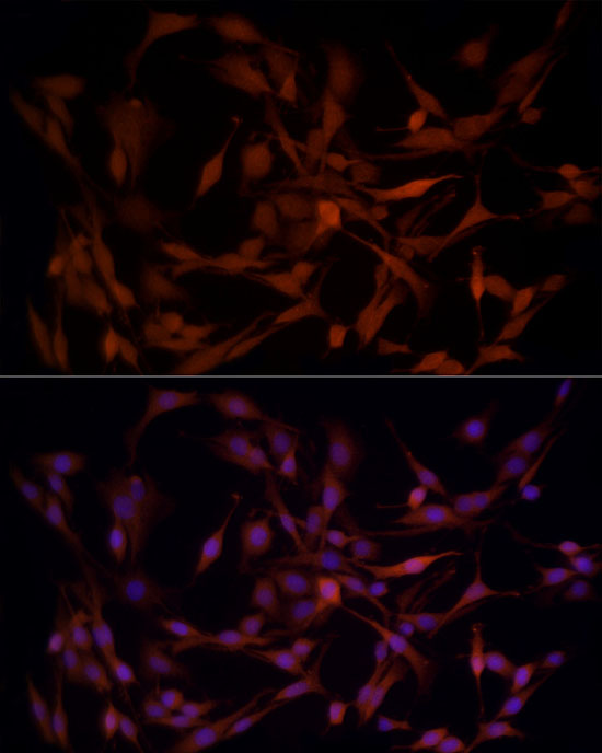 AKR1B1 Antibody