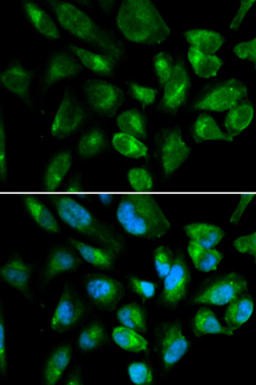 KIR2DL3 Antibody