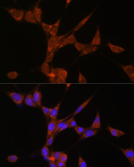 AKR1C3 Antibody