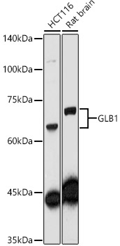 GLB1 Antibody