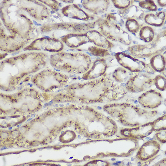 GLB1 Antibody