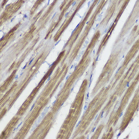 GLB1 Antibody