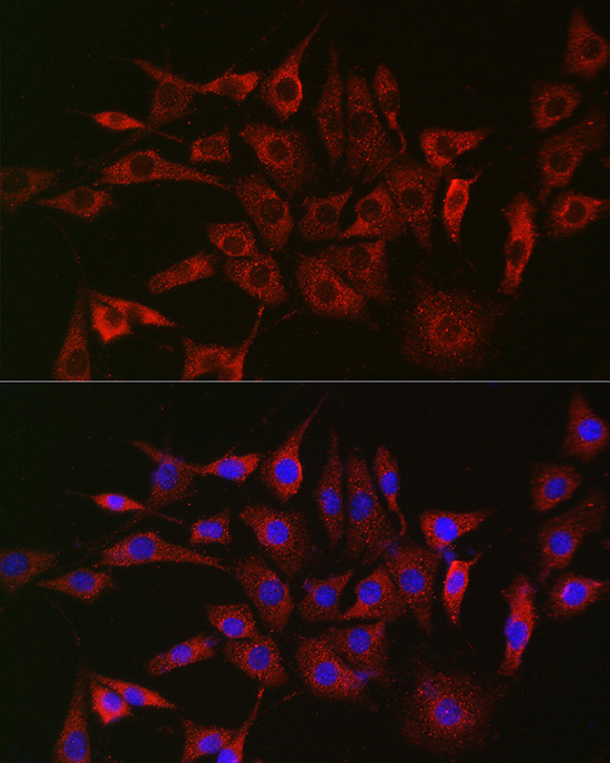 GLB1 Antibody