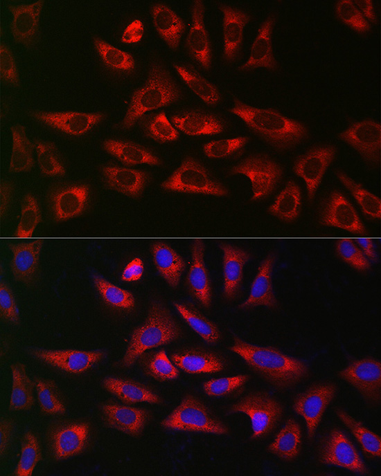 GLB1 Antibody