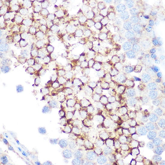 GPX4 Antibody