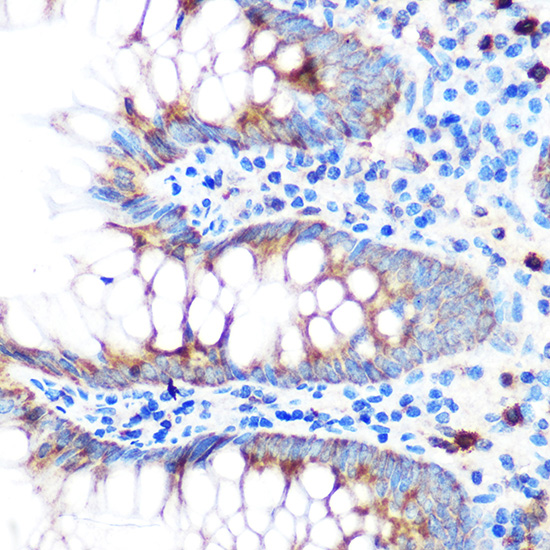 GPX4 Antibody