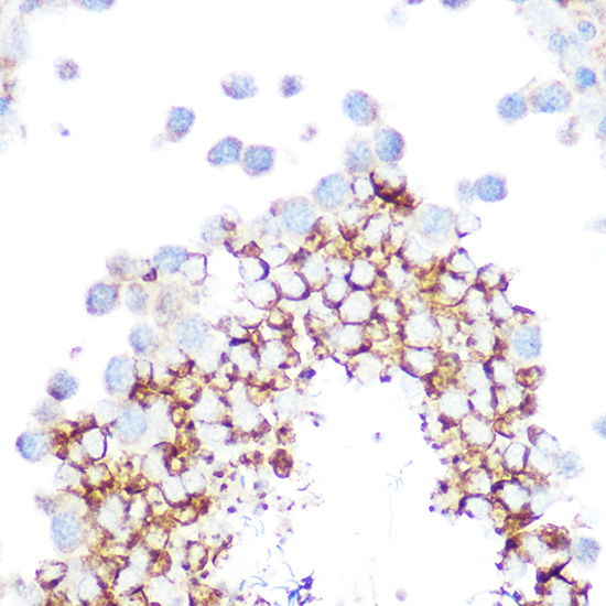 GPX4 Antibody