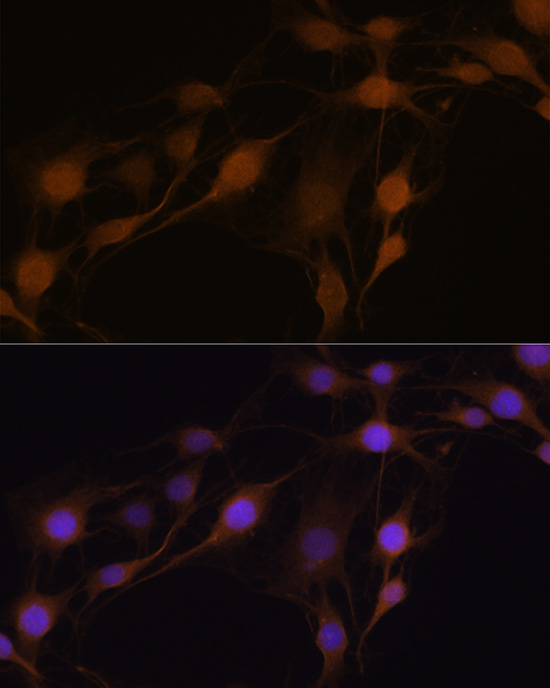 GPX4 Antibody