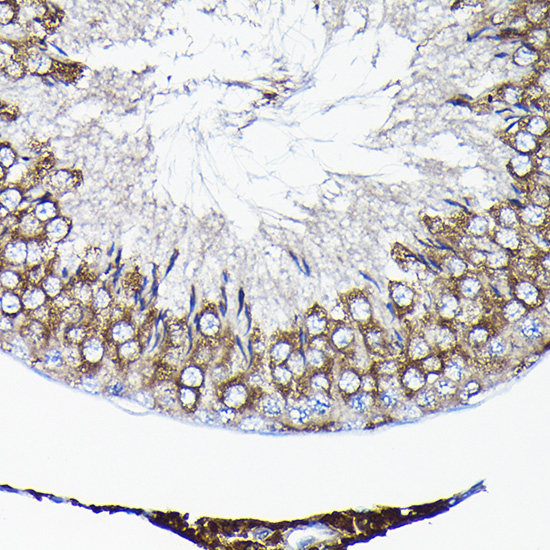 TCP1 Antibody