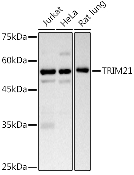 TRIM21 Antibody