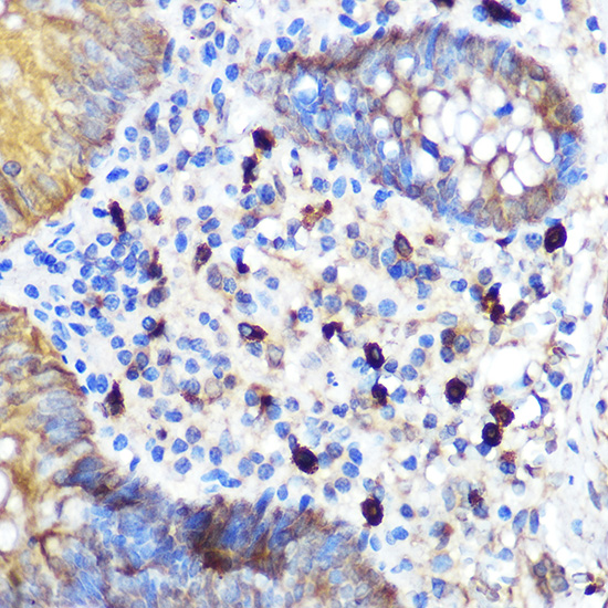 TRIM21 Antibody