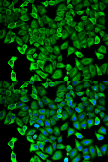 PSMD2 Antibody